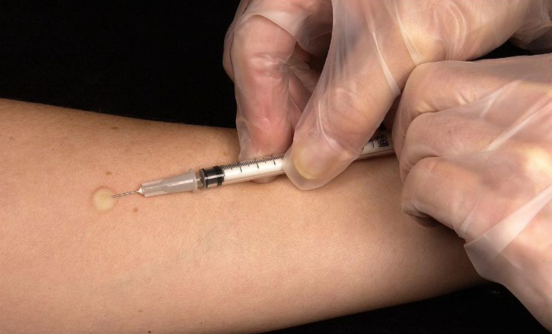 Refuerzan vigilancia epidemiológica en Jalisco